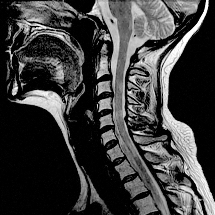 “Movement Like Breathing” by Diane Chavez